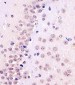 TBP Antibody